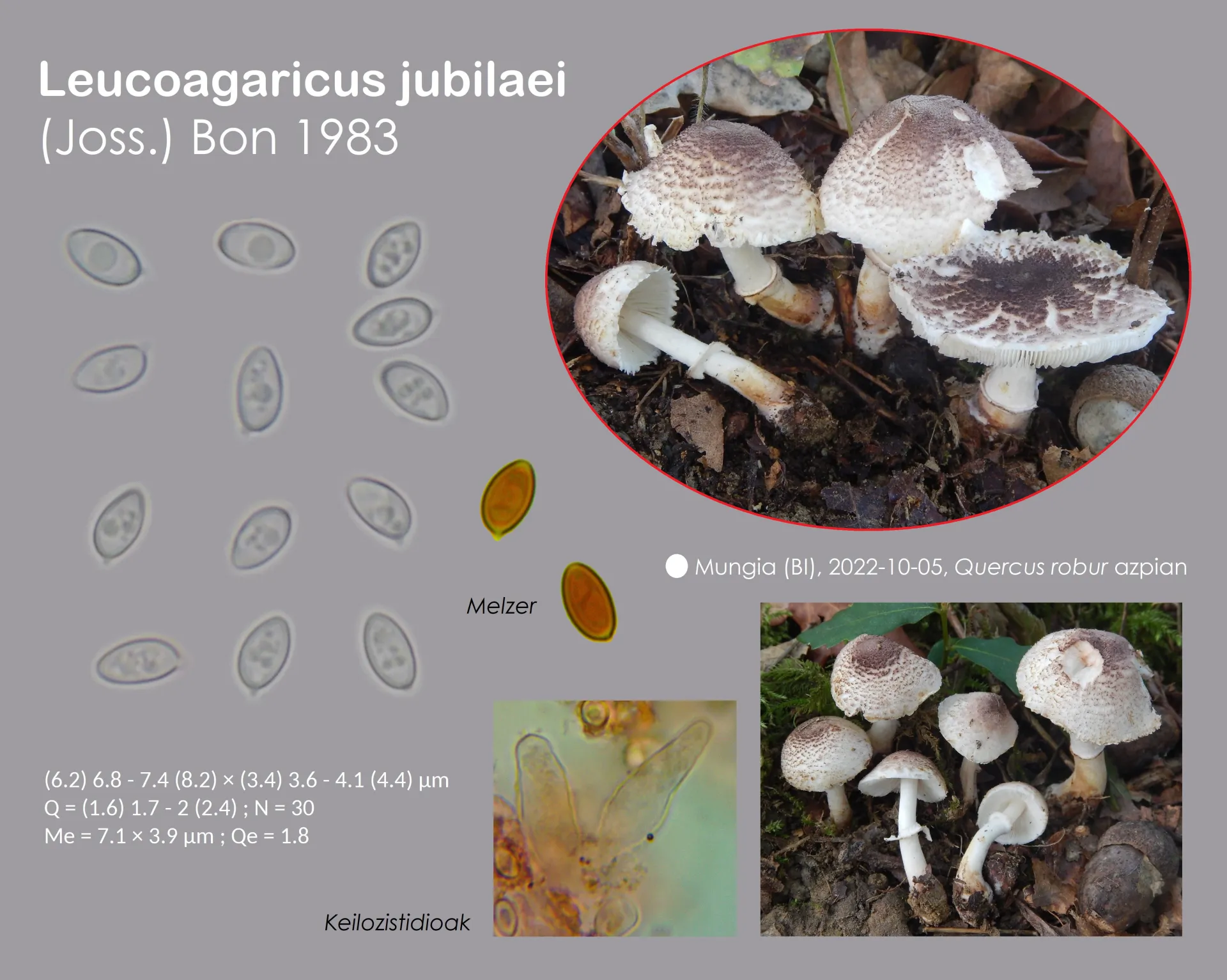 Microscopía de Leucoagaricus jubilaei